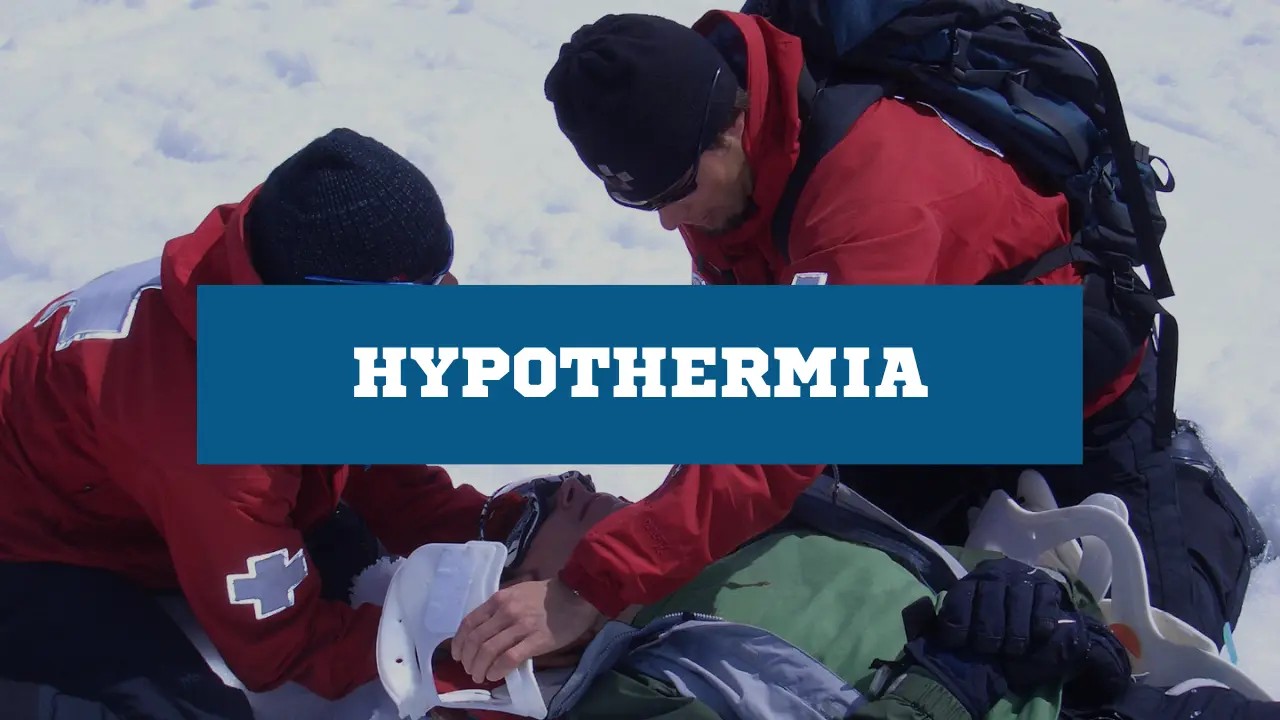 Hypothermia First Aid Guide Causes, Symptoms, and Treatment